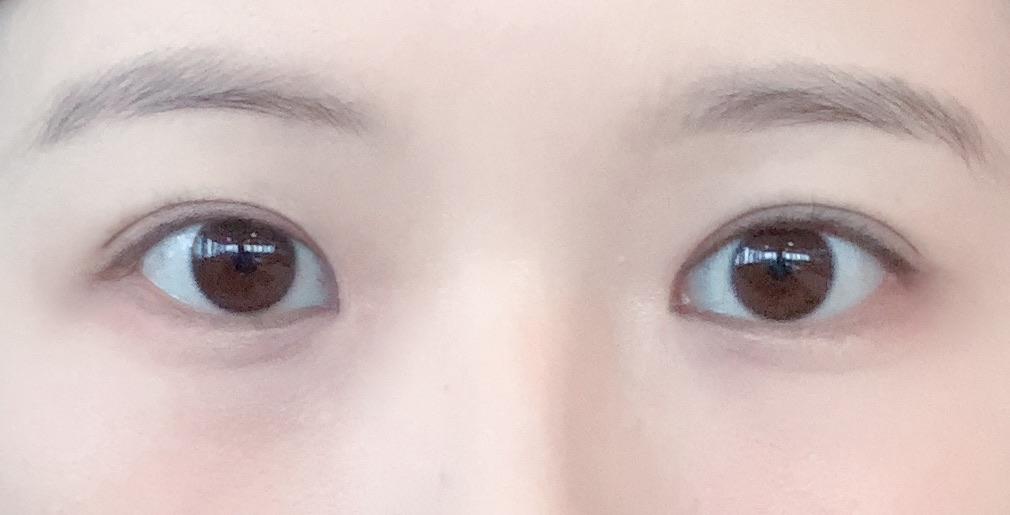 後