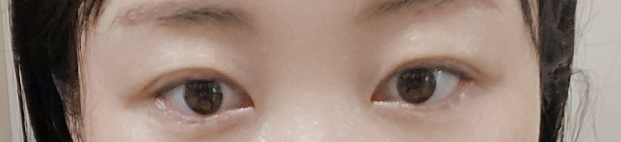 後