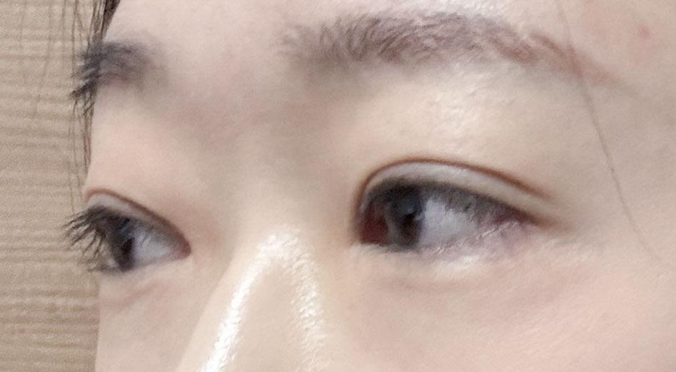 後