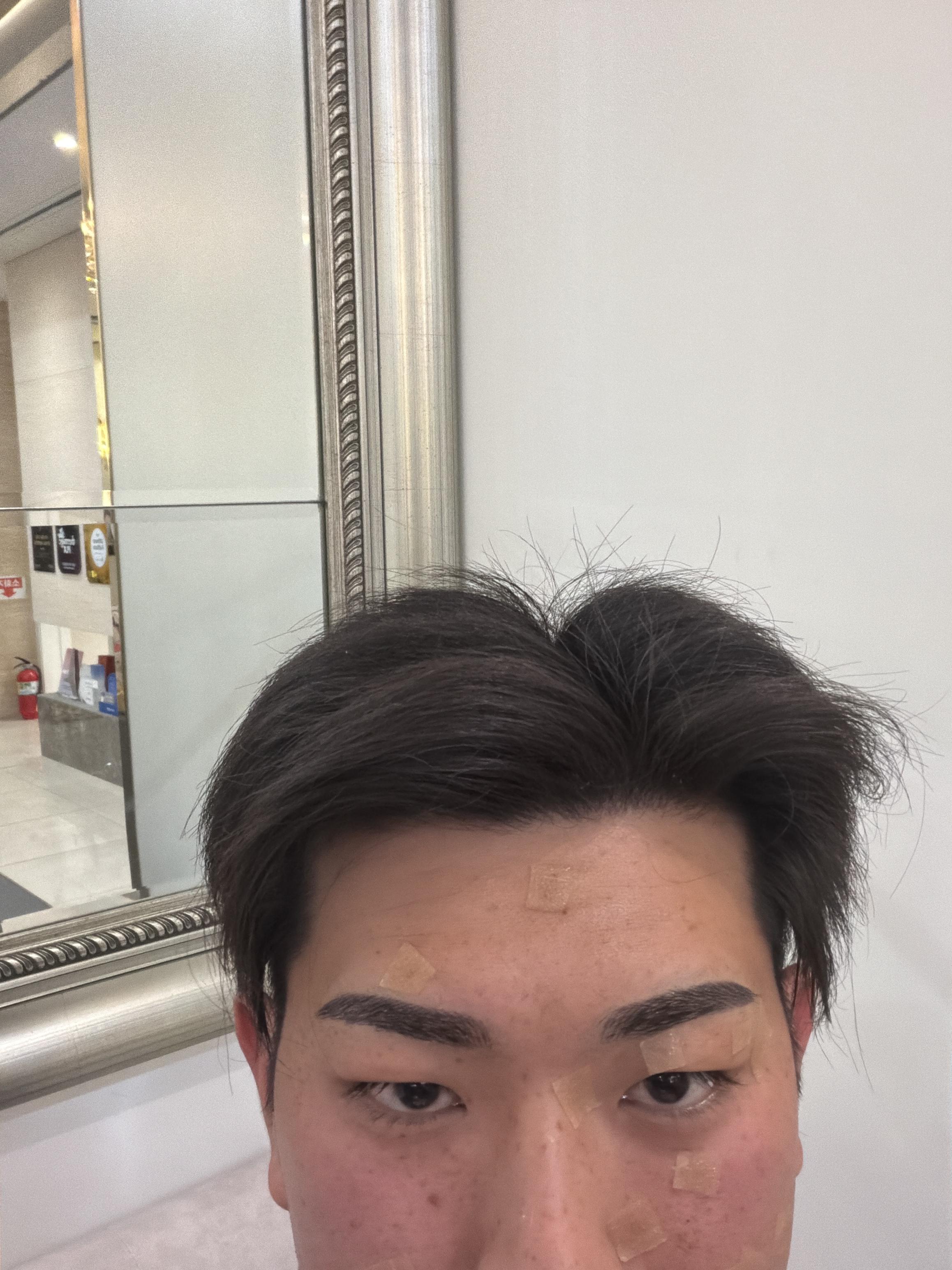 後