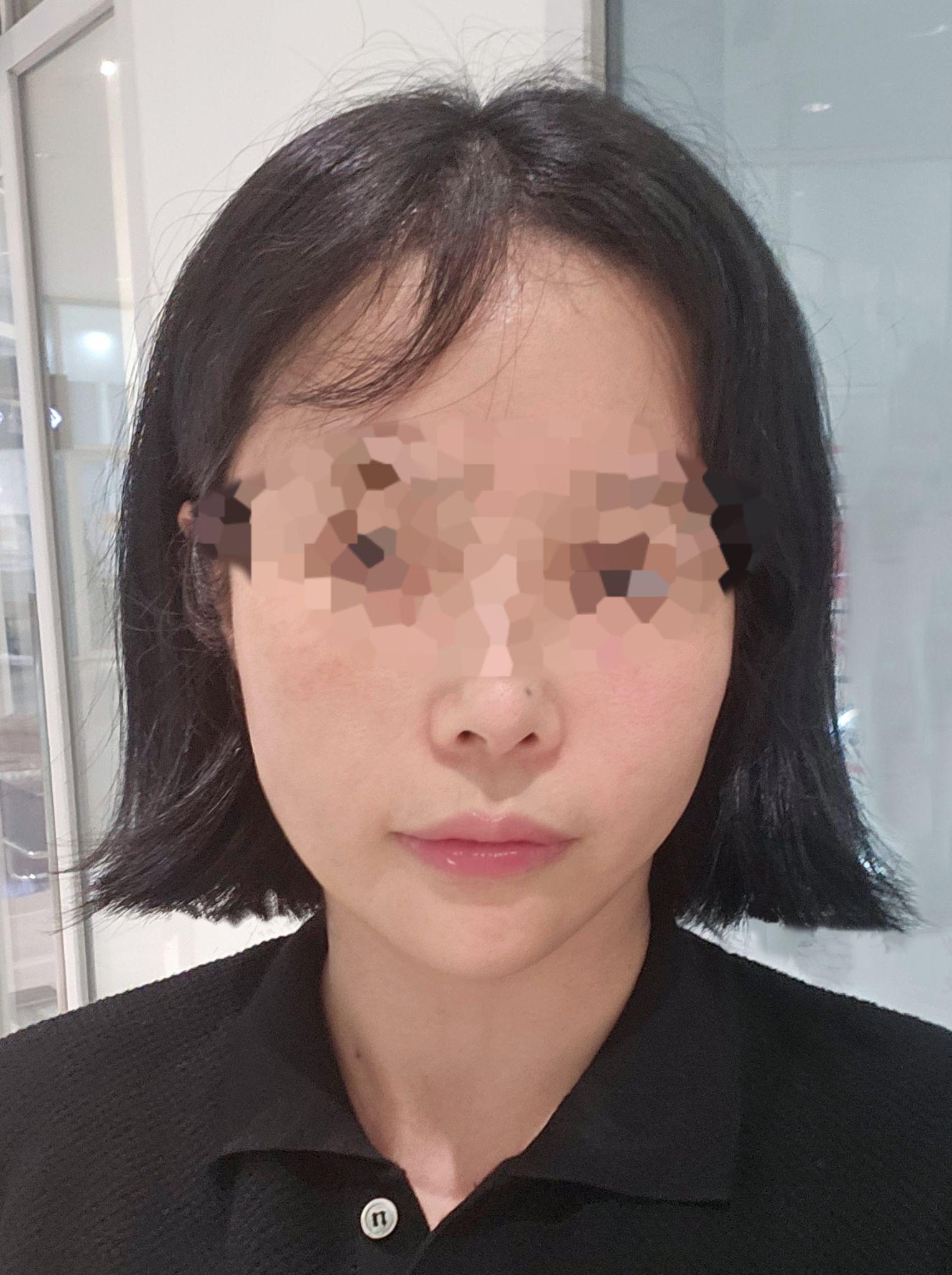 後