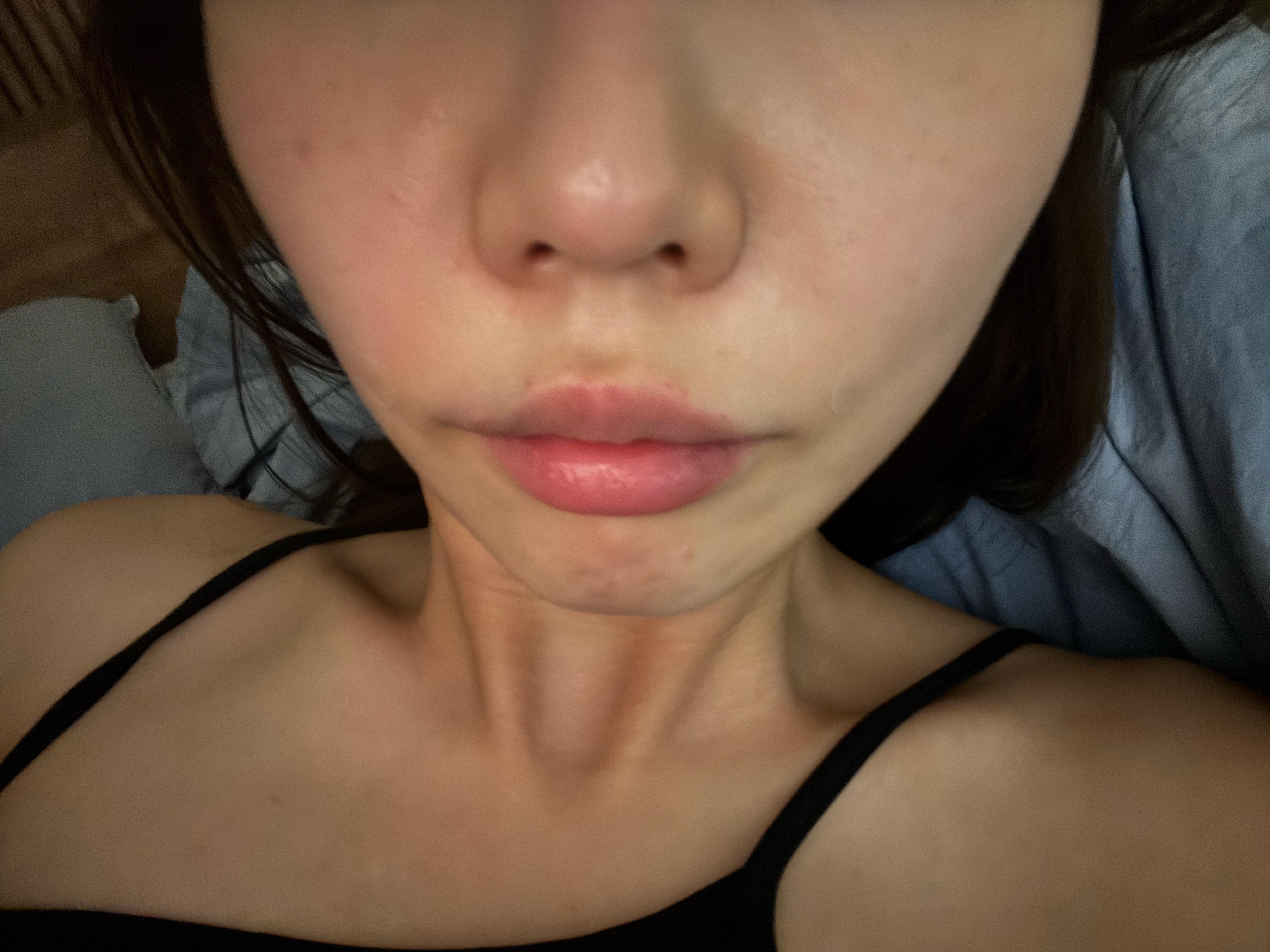 後