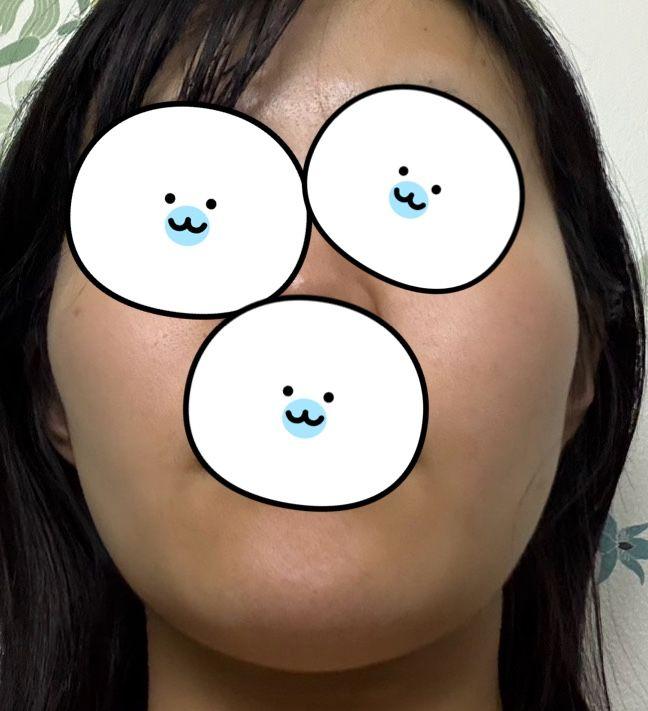 後