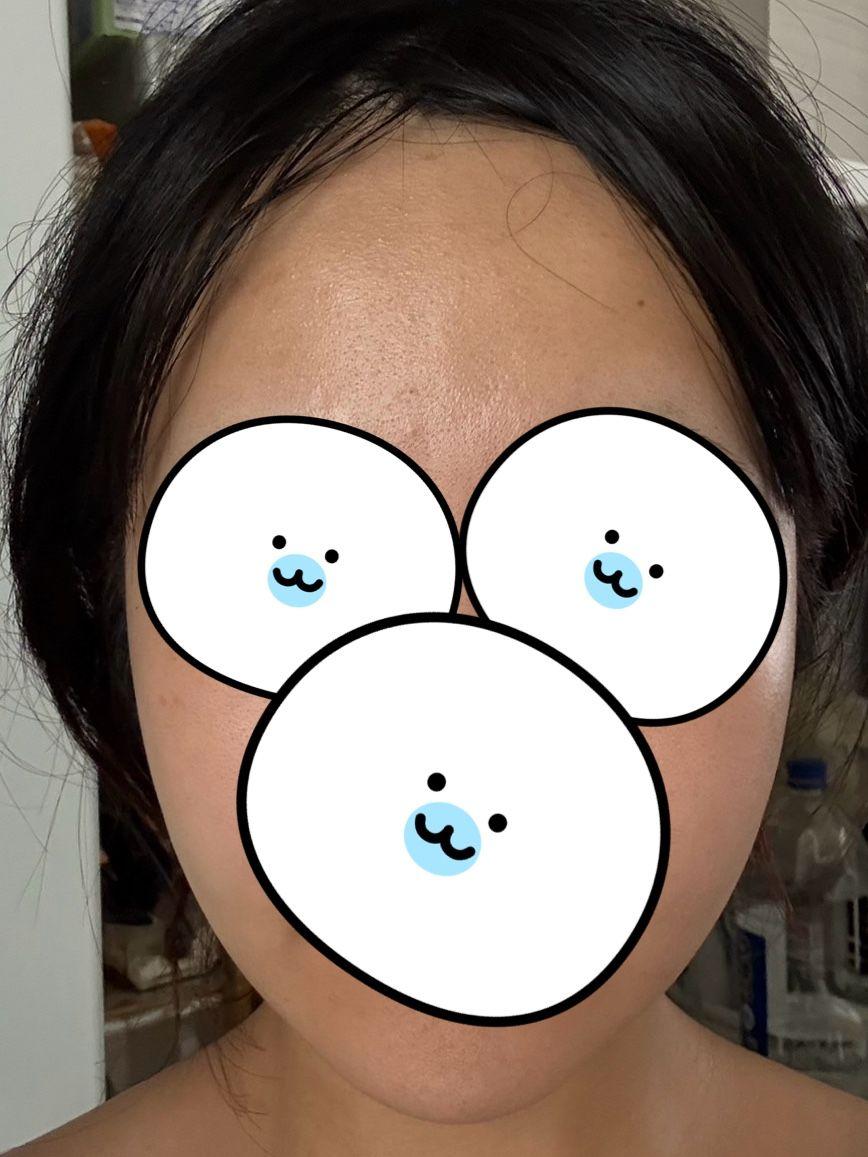 後
