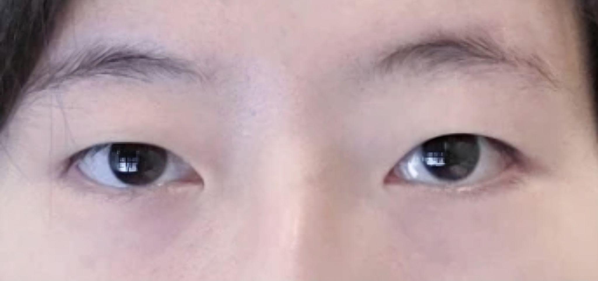 前