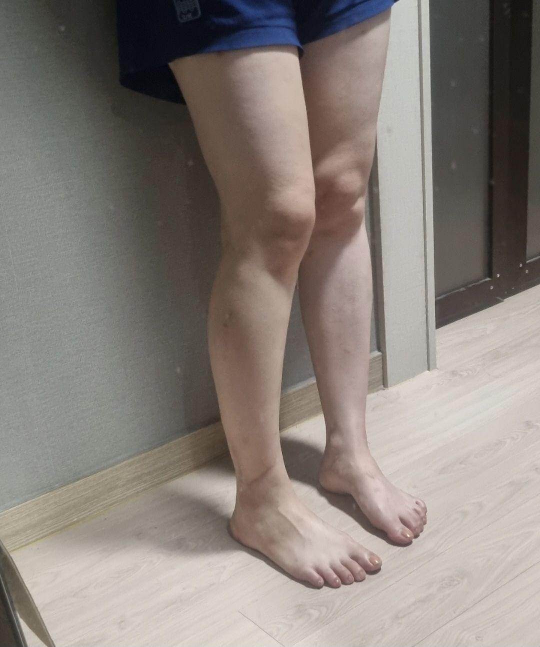 前