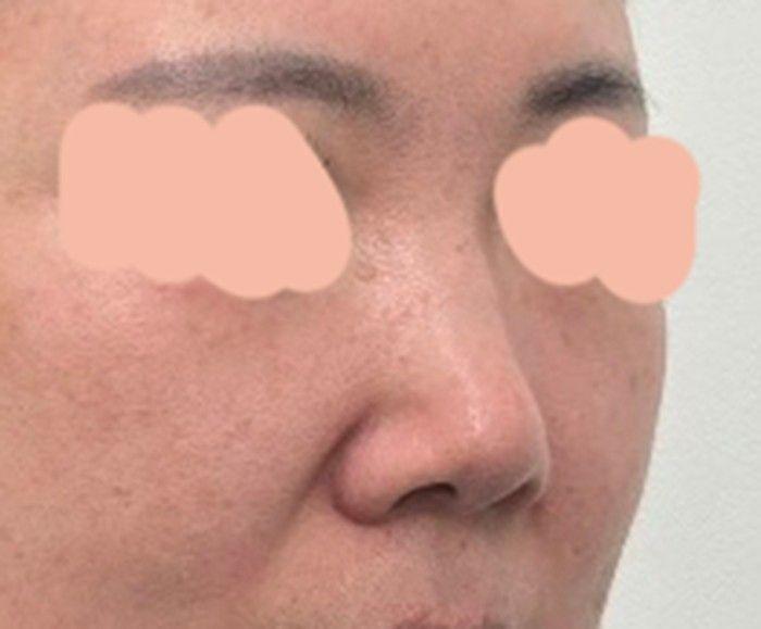 後