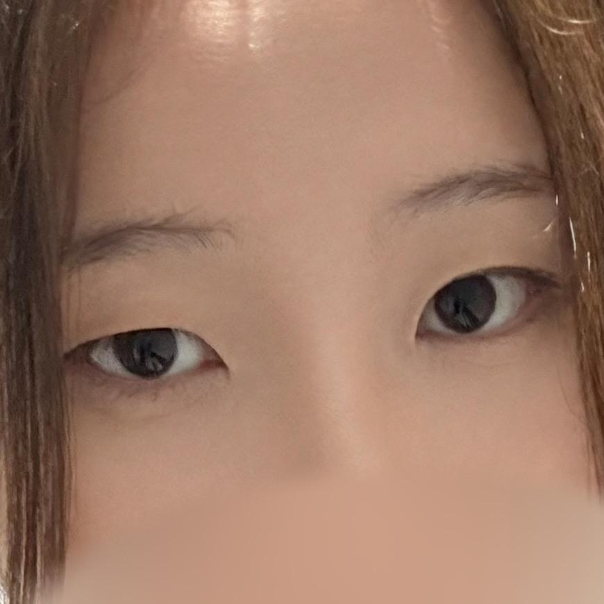 後