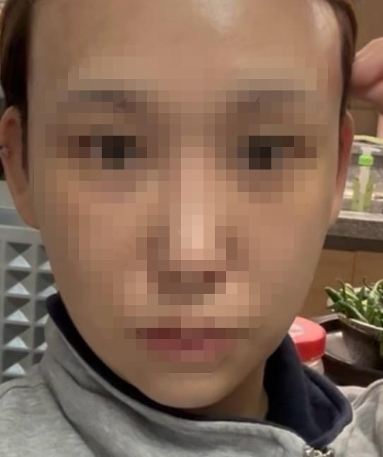 前
