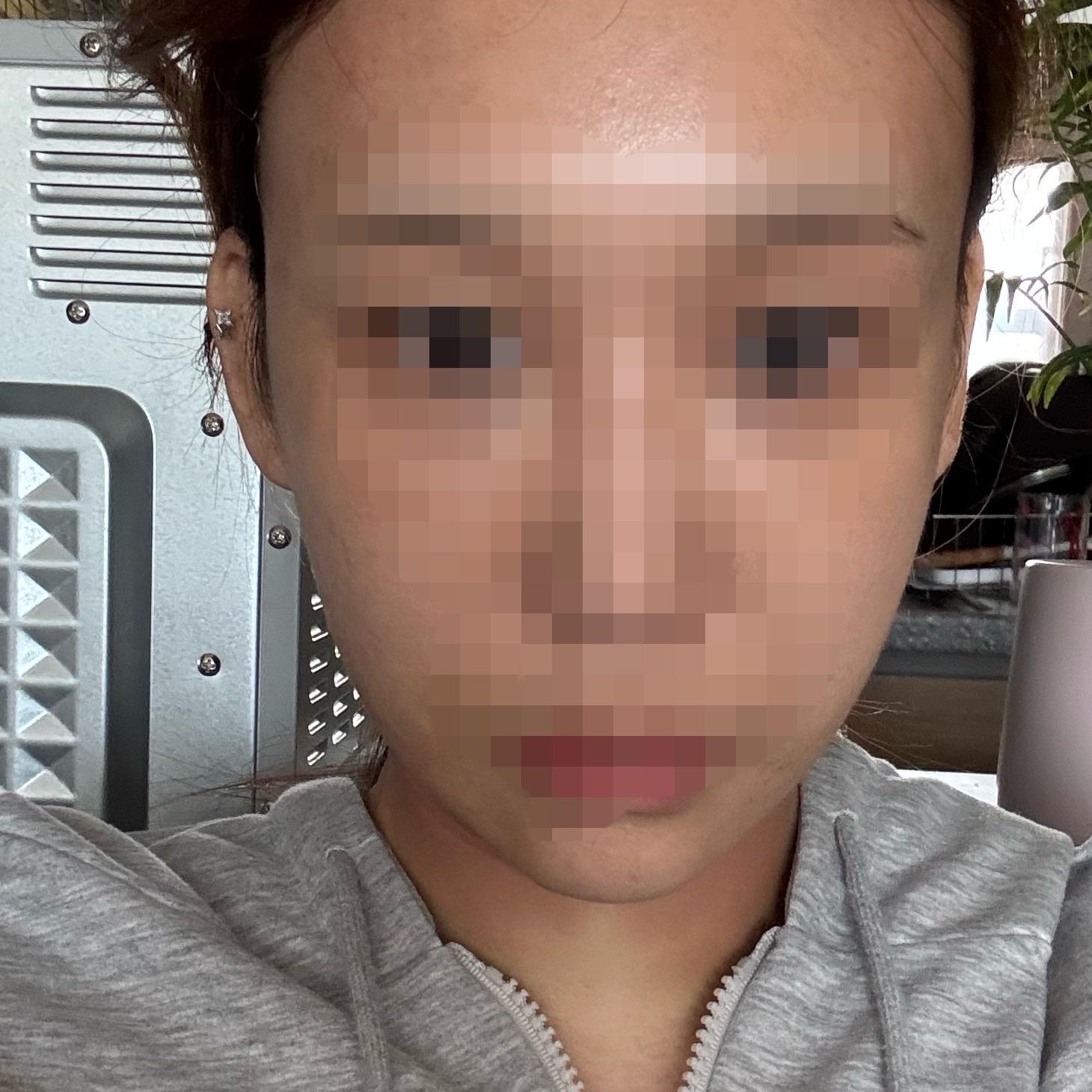 后