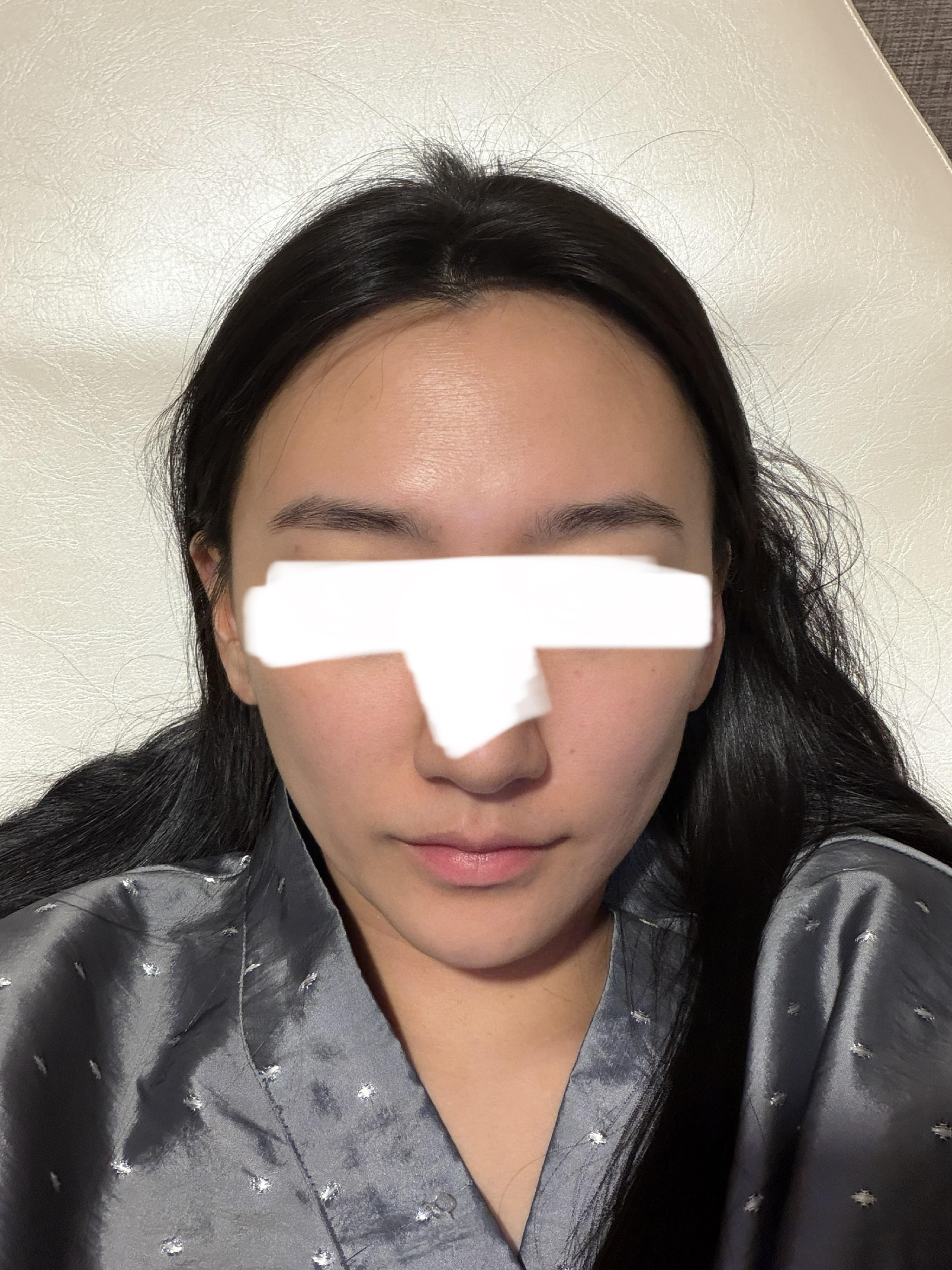 後