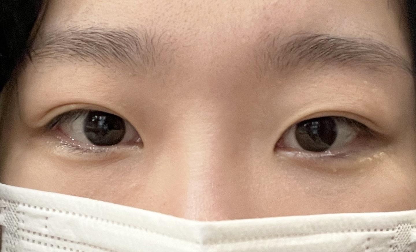後