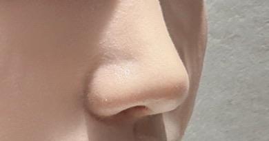 後