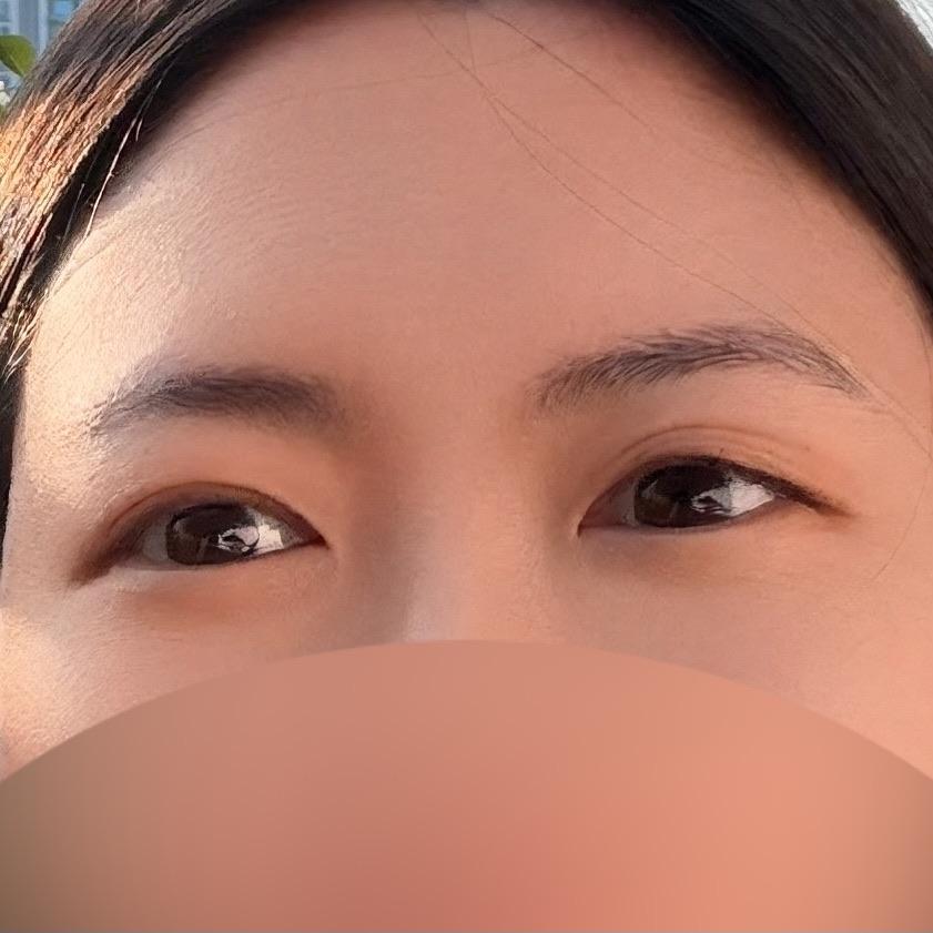 後