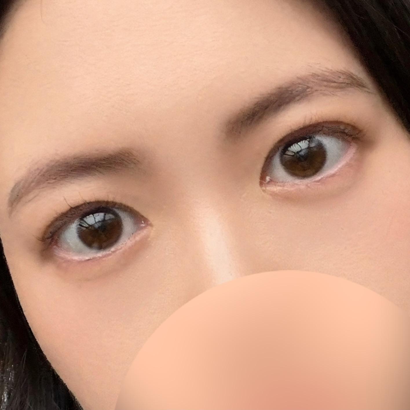 後