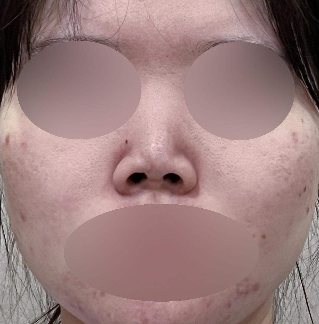 後