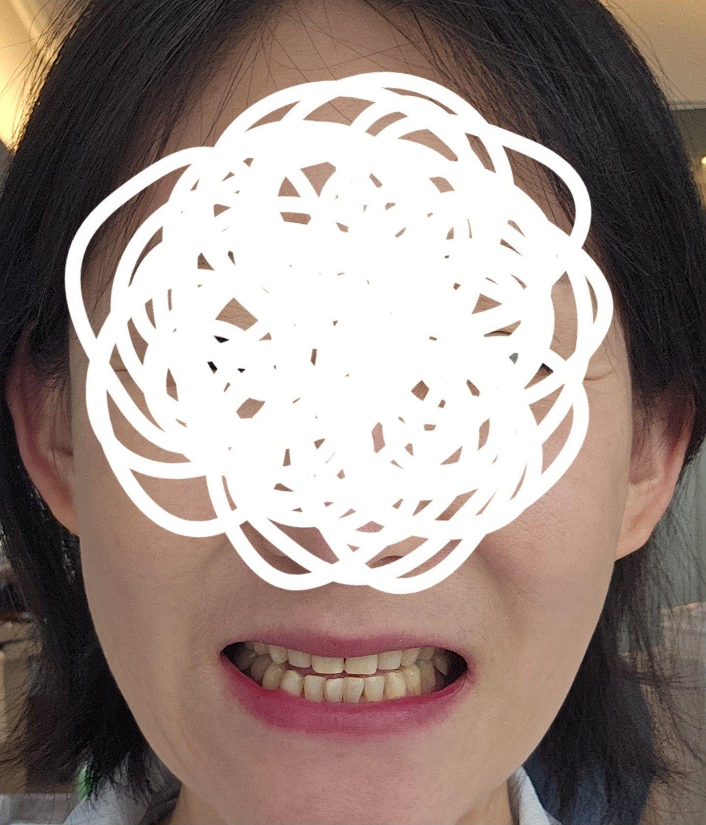 後