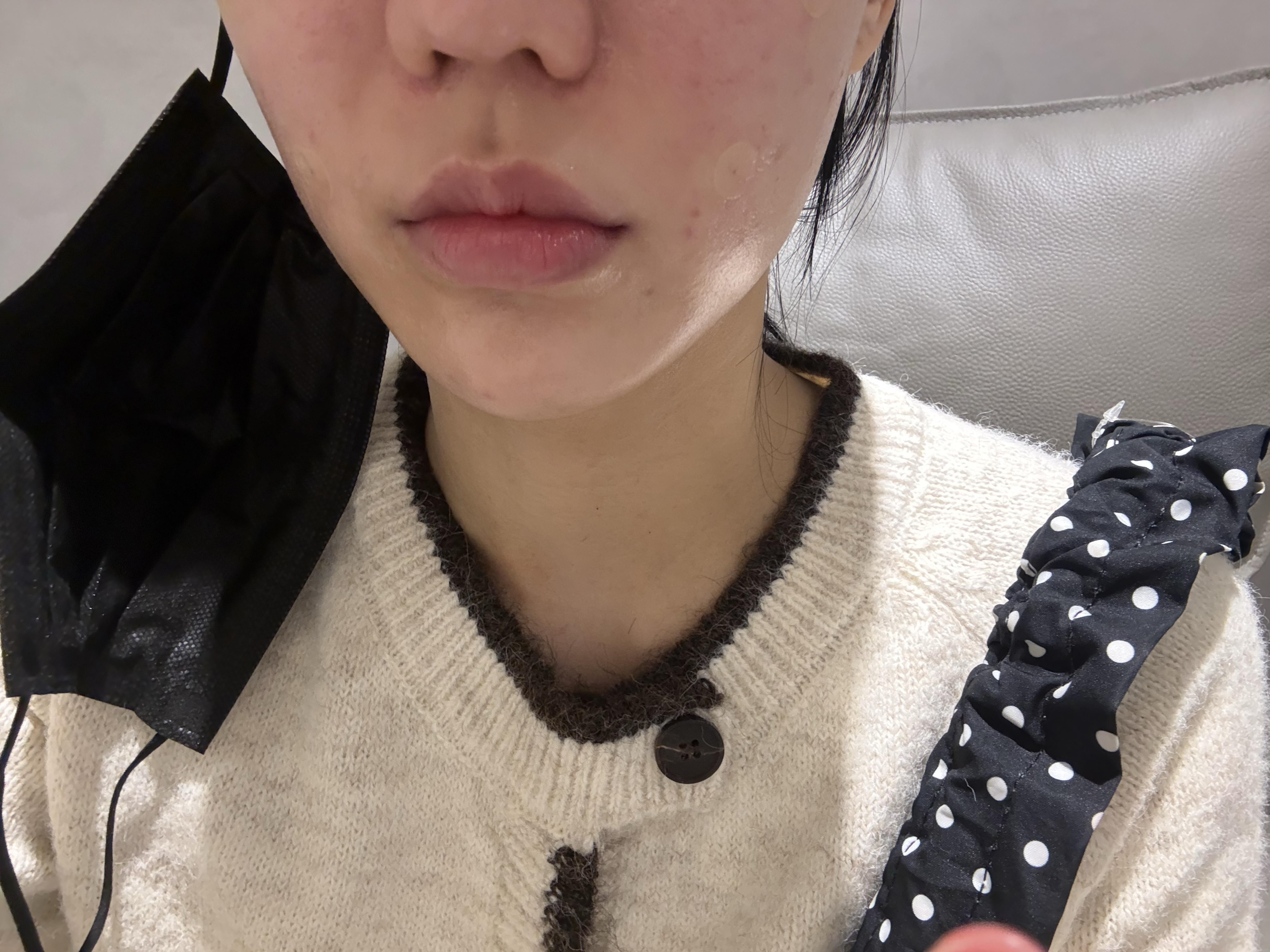 後