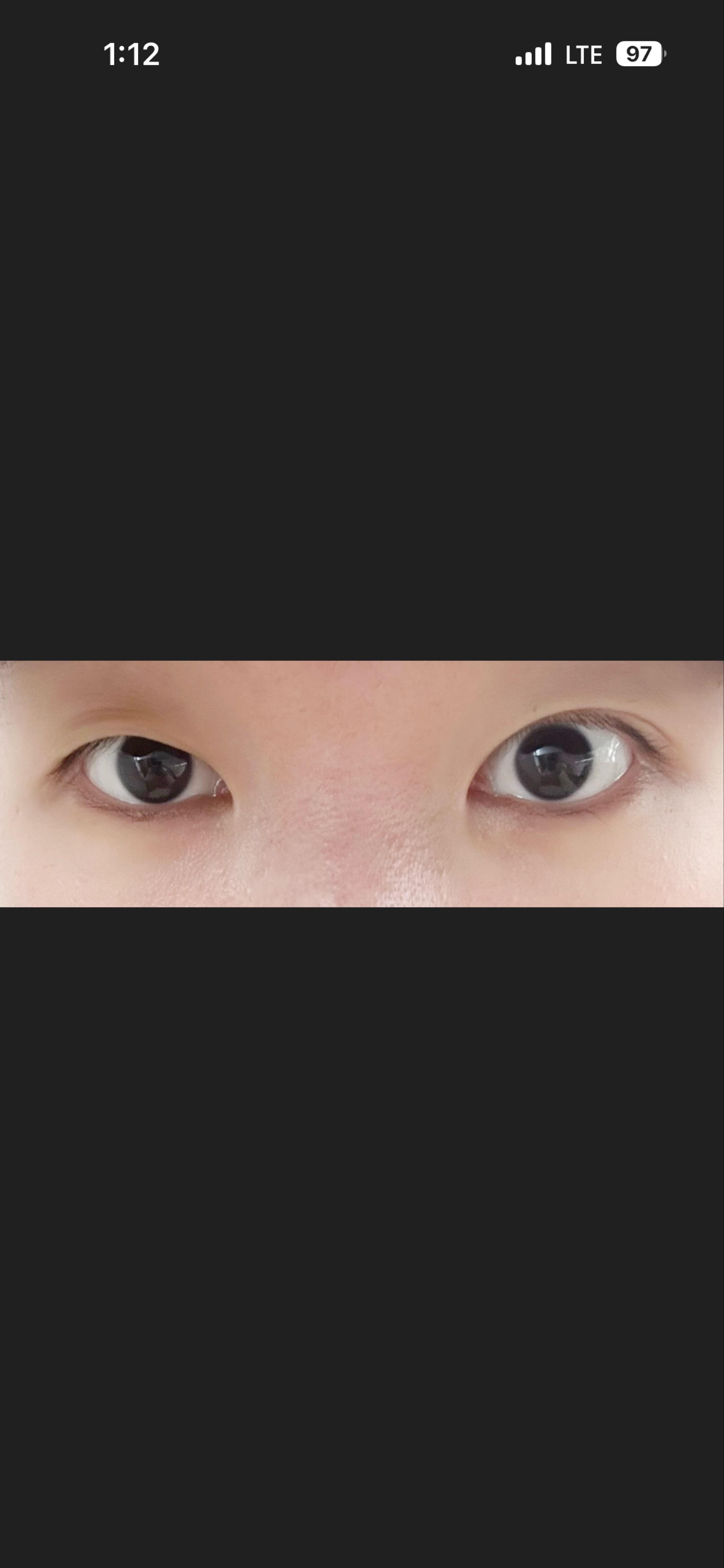 後