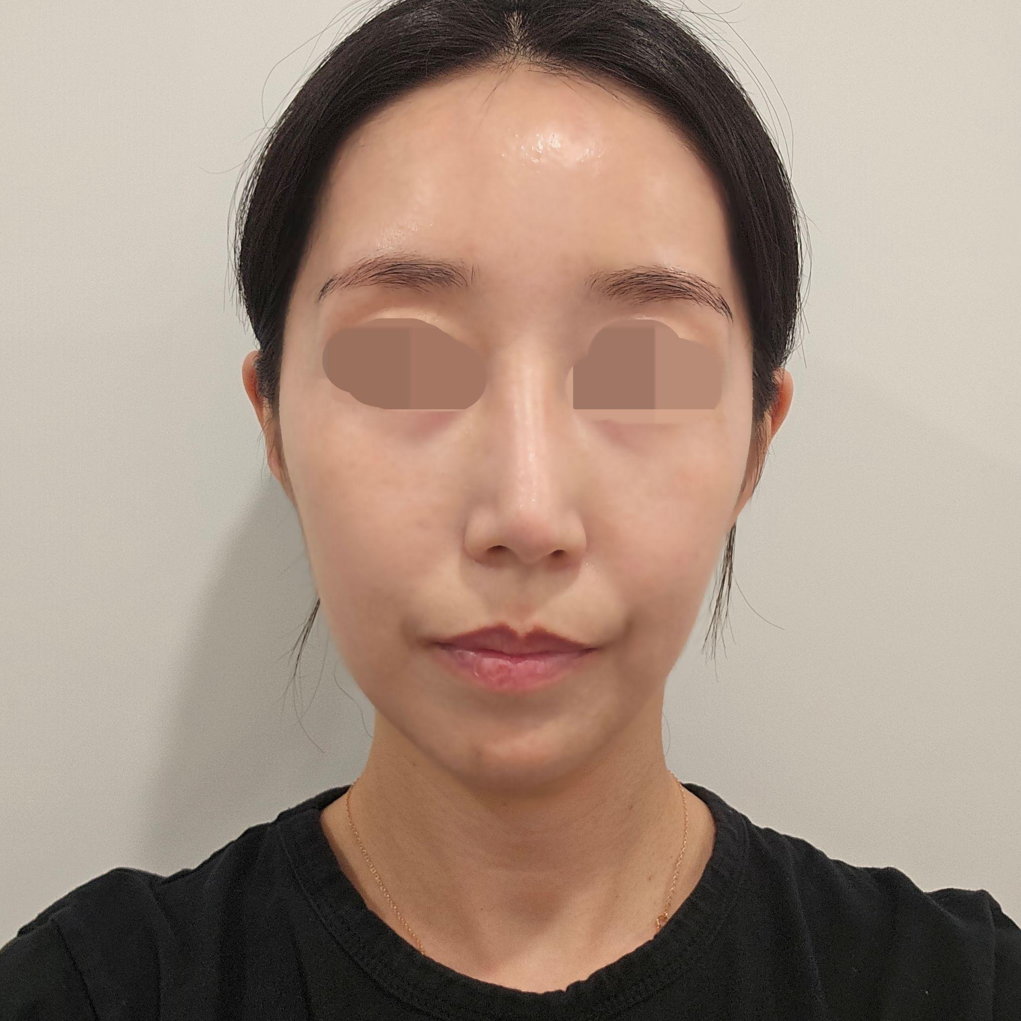 後