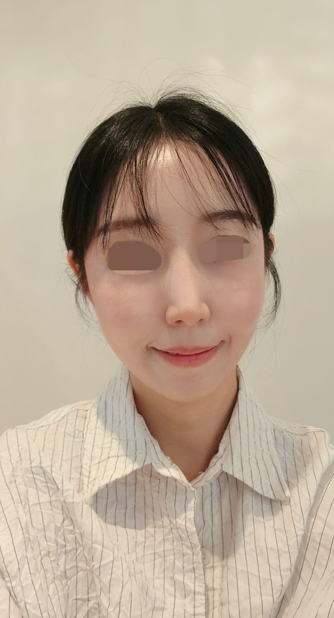 後