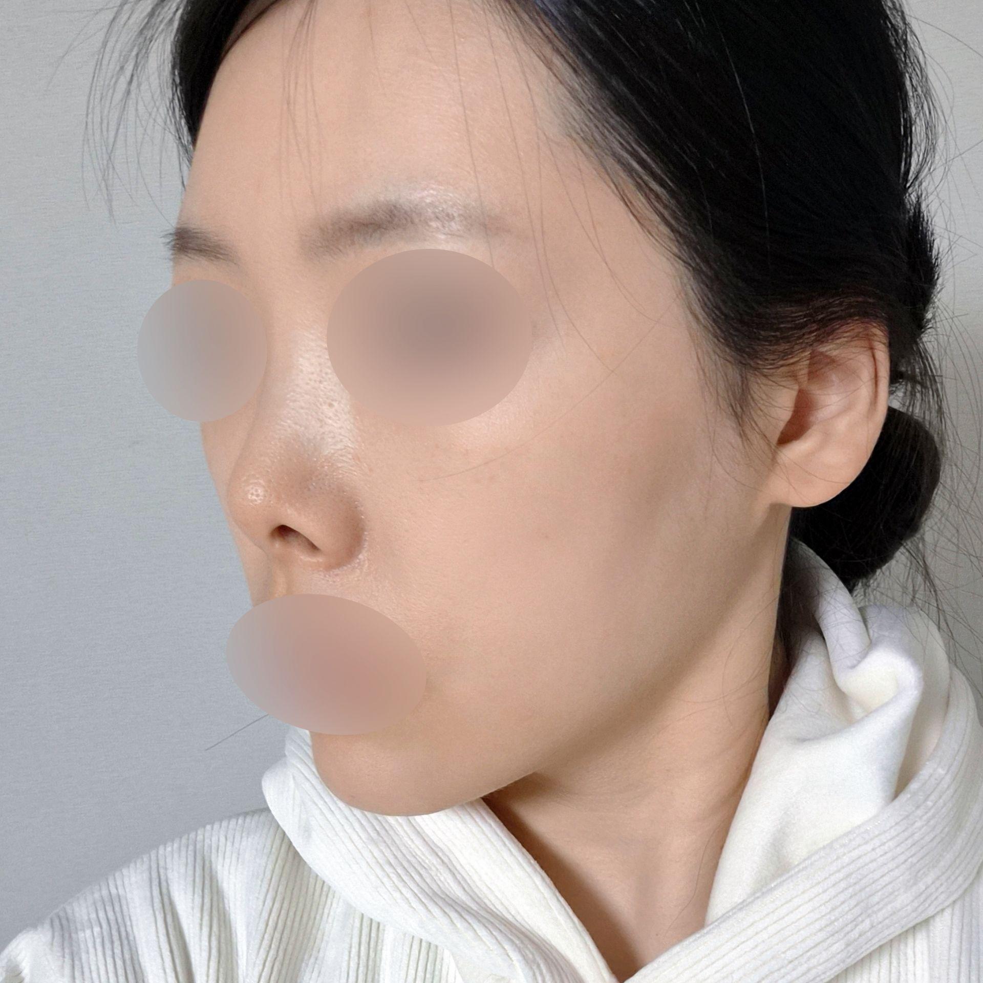 後