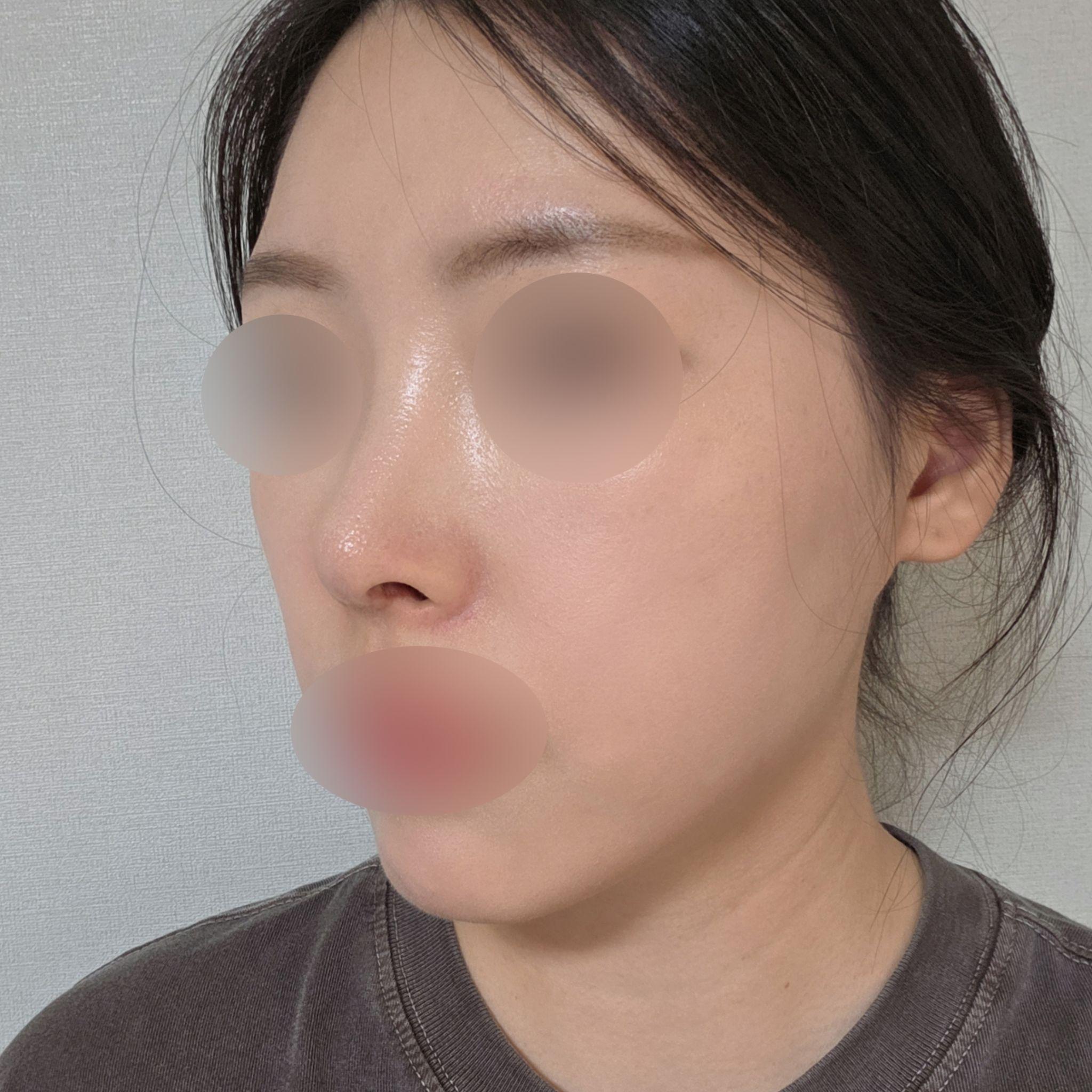 後