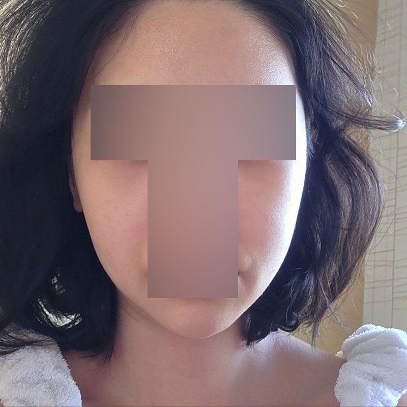 后