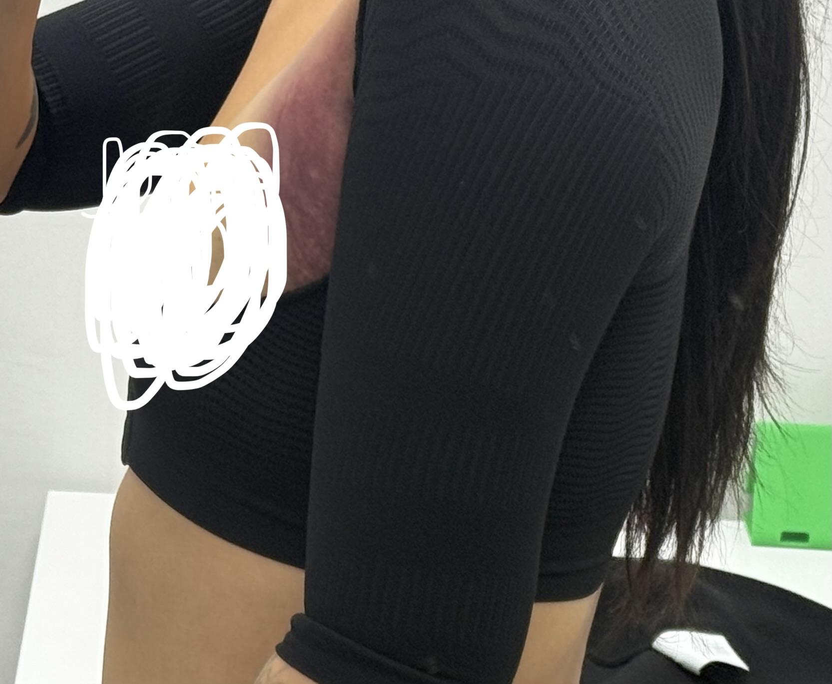 後