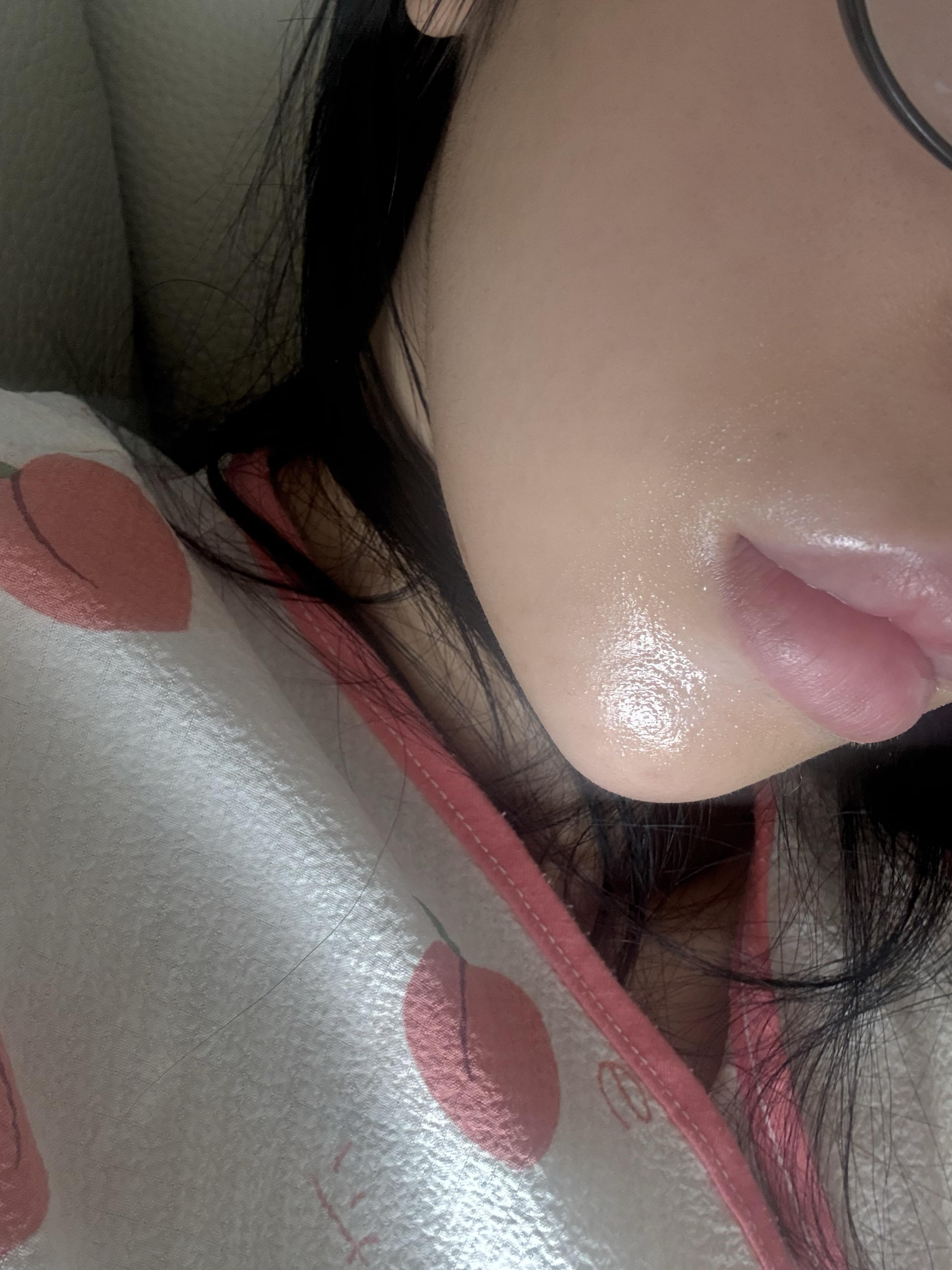 後