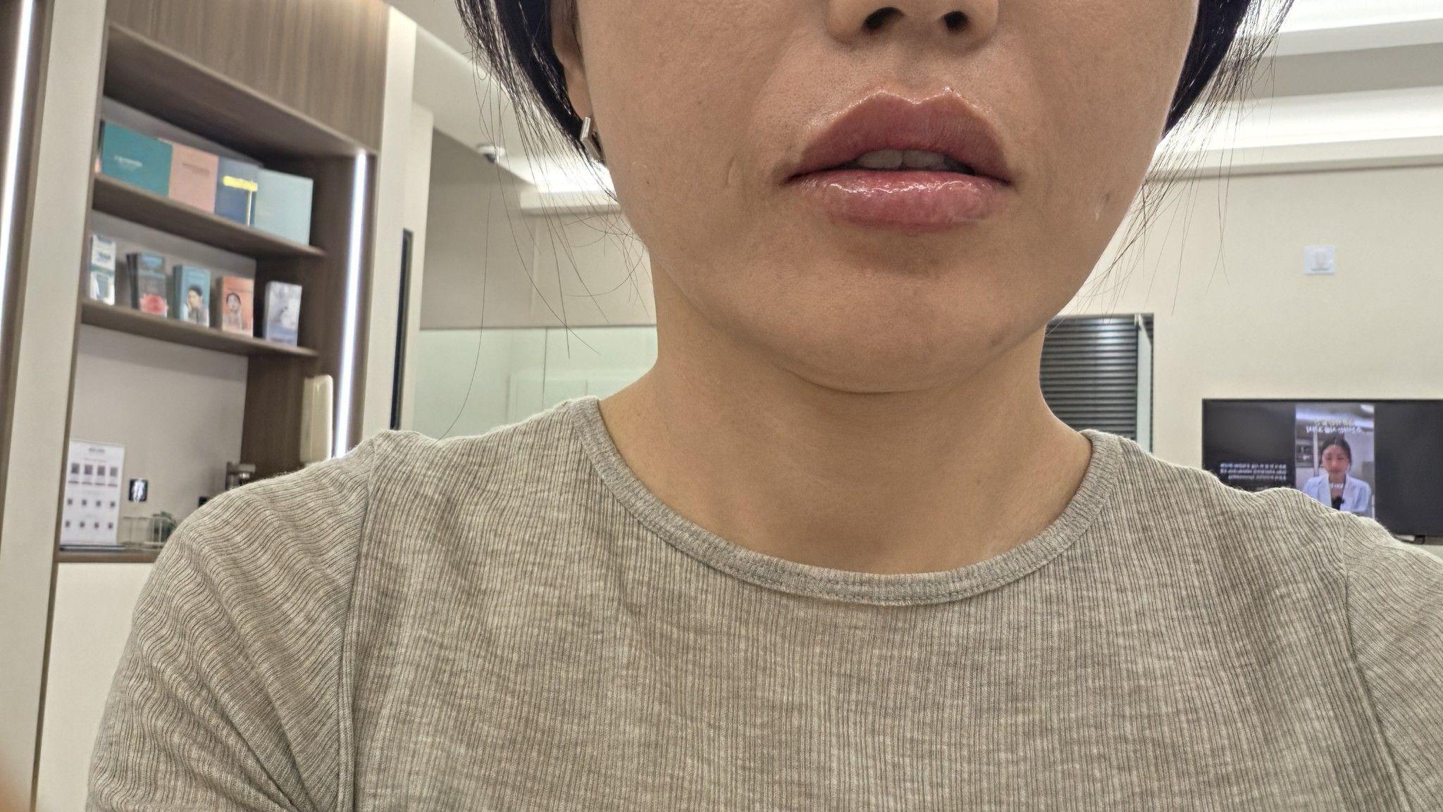 After