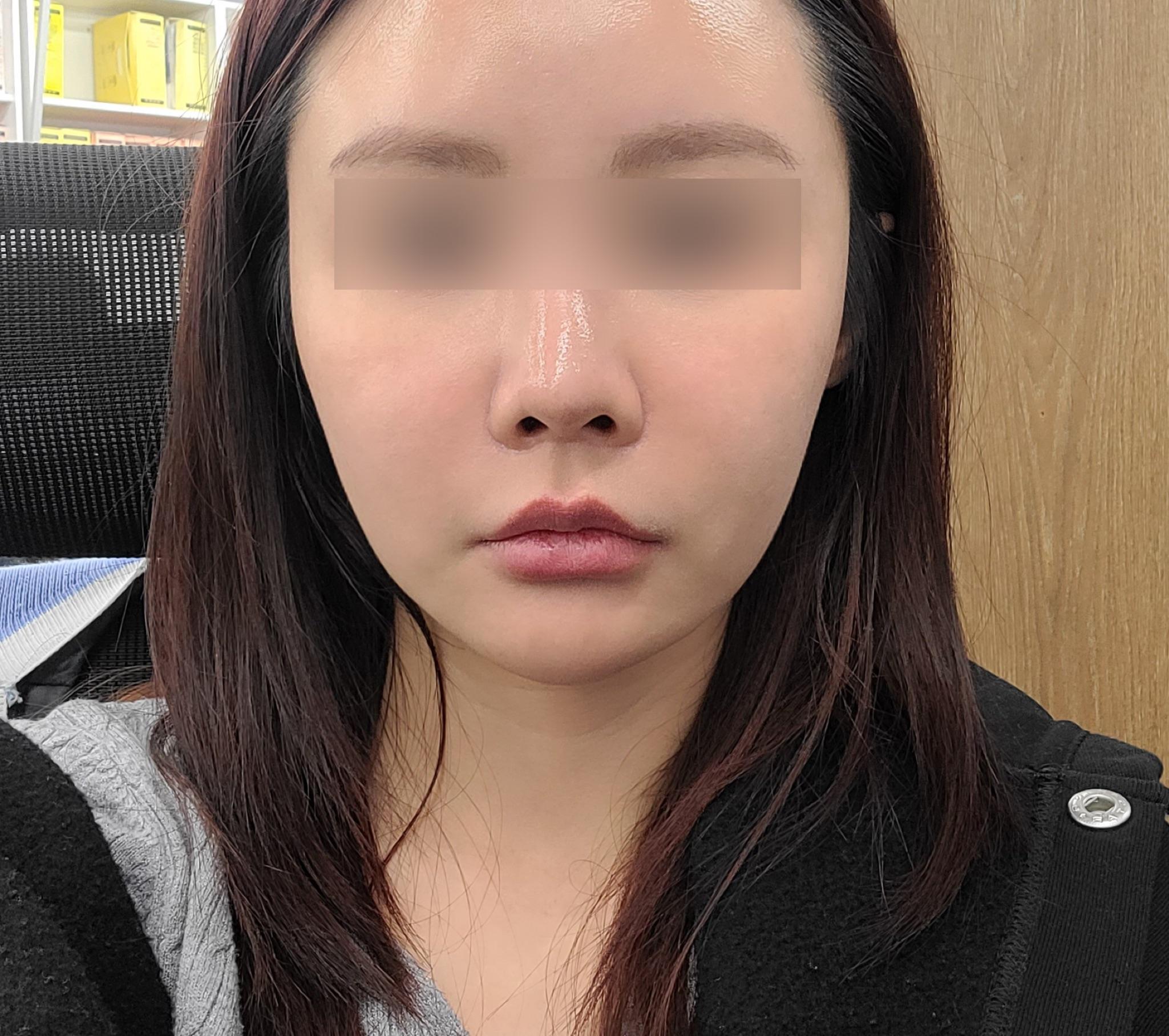 後