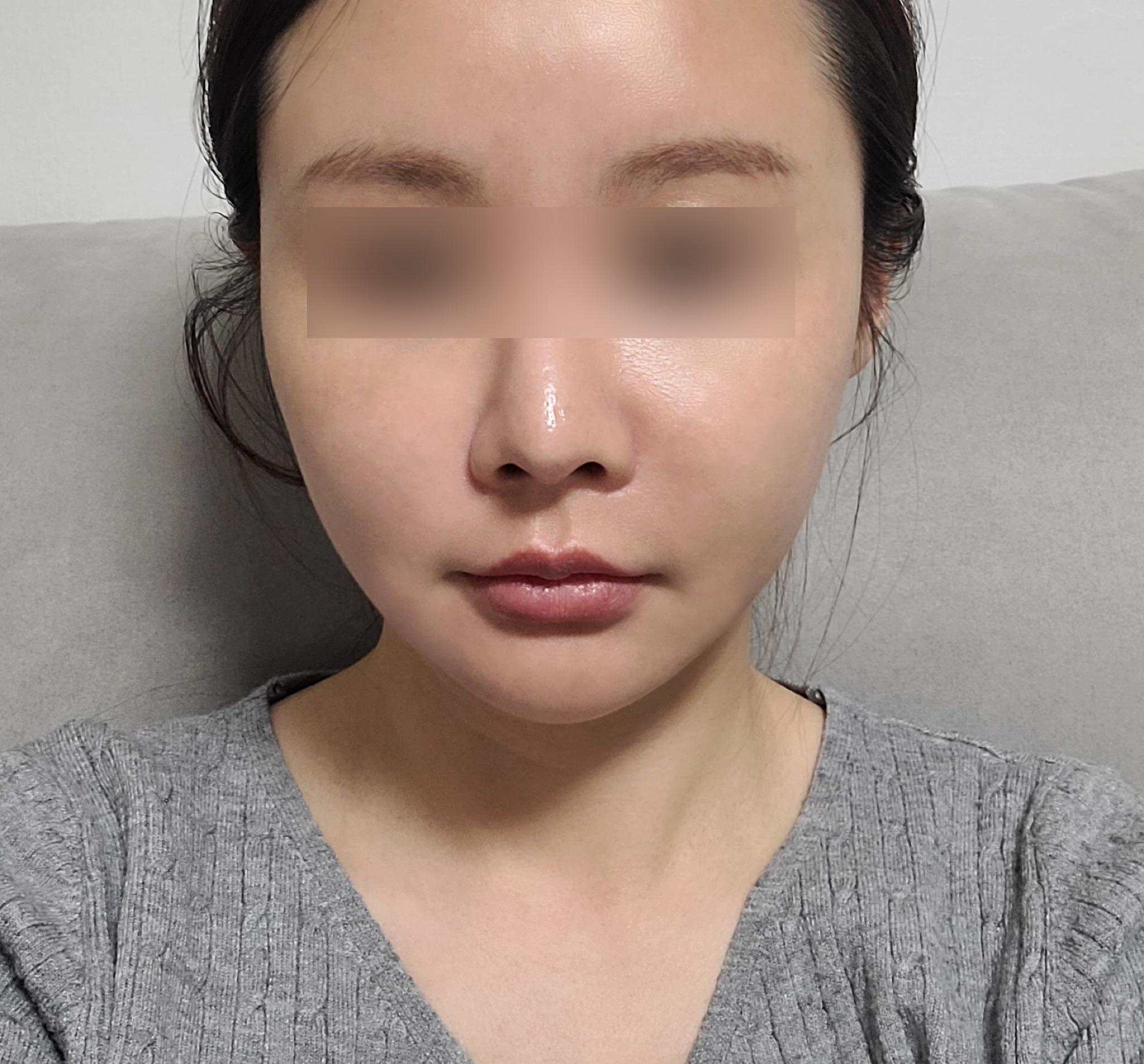 後