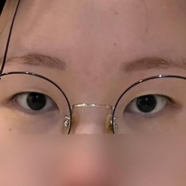 後