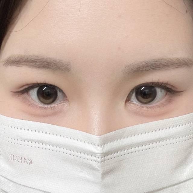 後