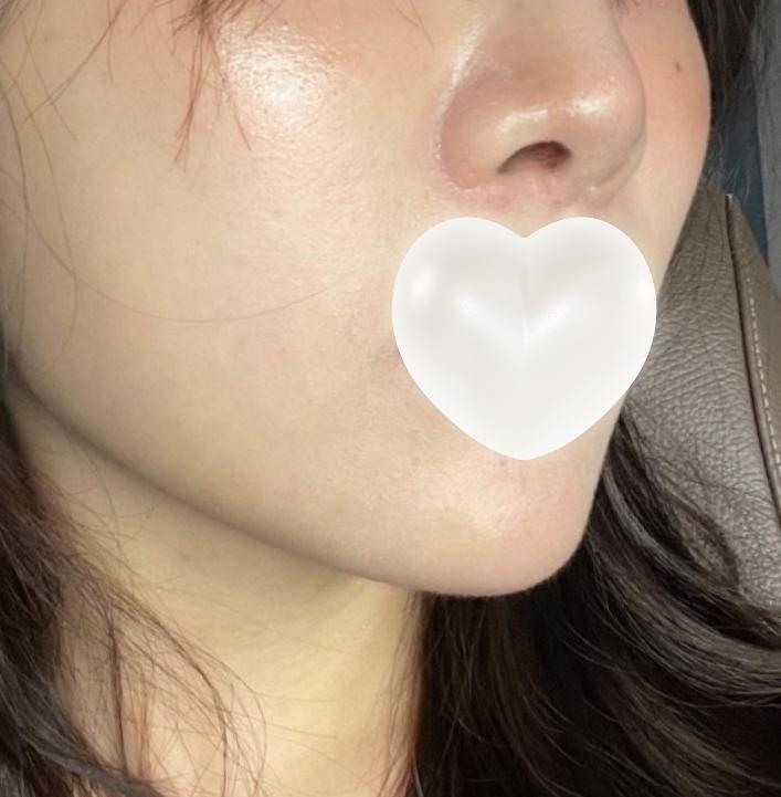 后