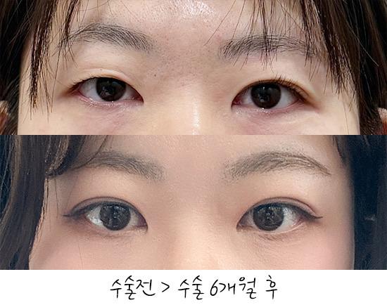 后