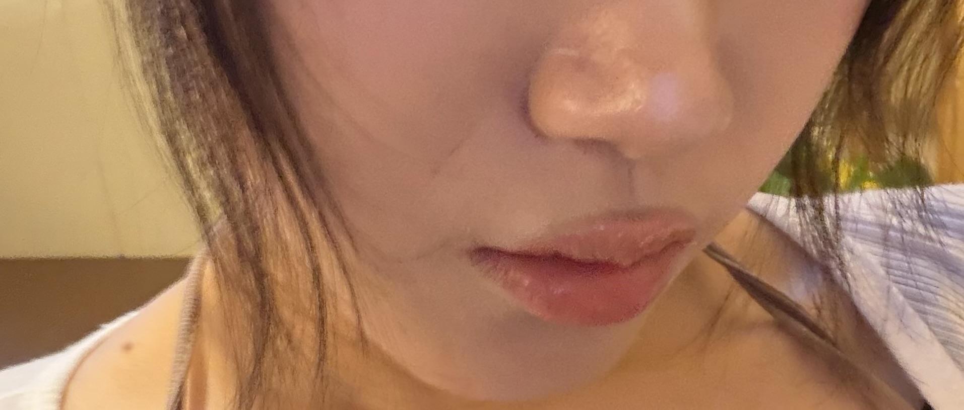 後