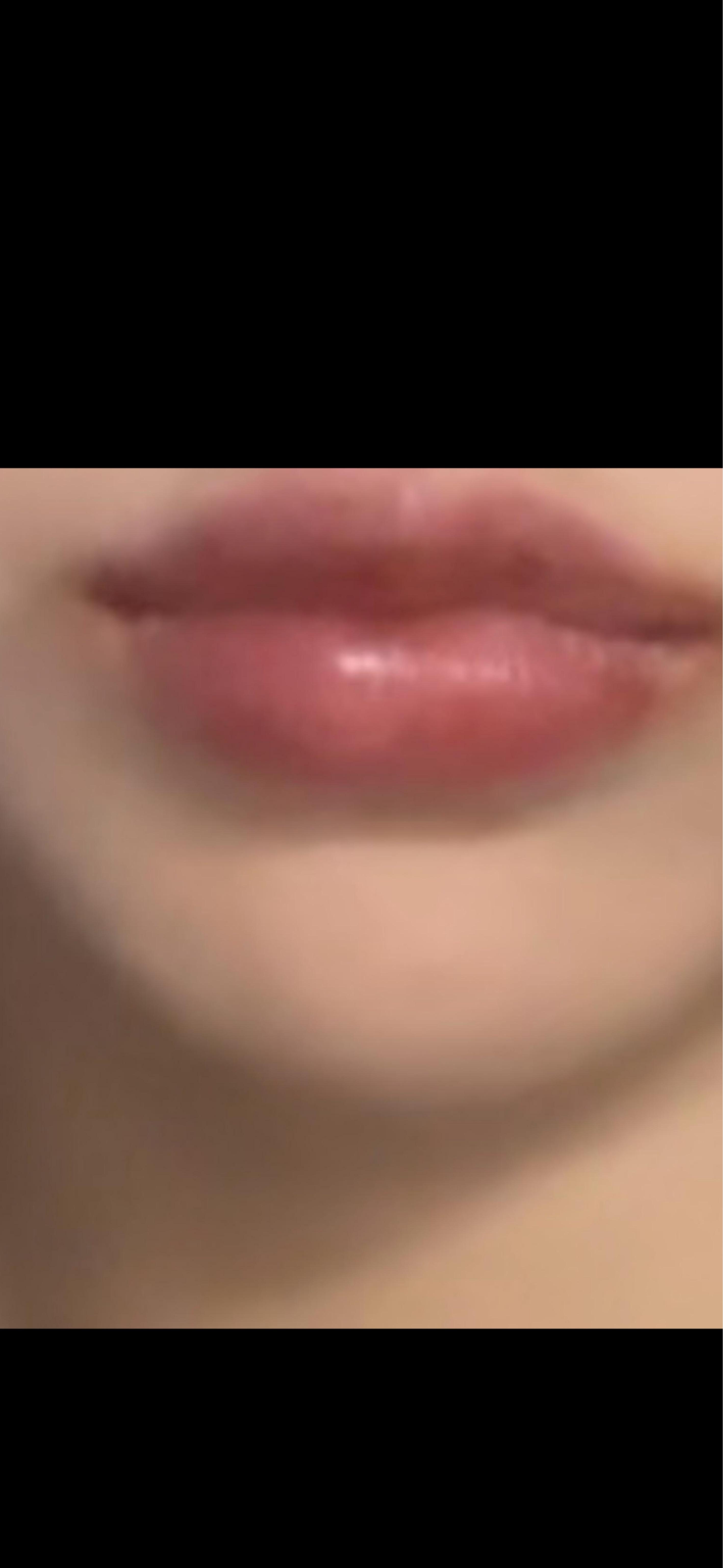 後