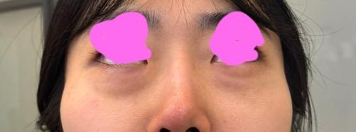 後