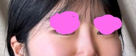 後
