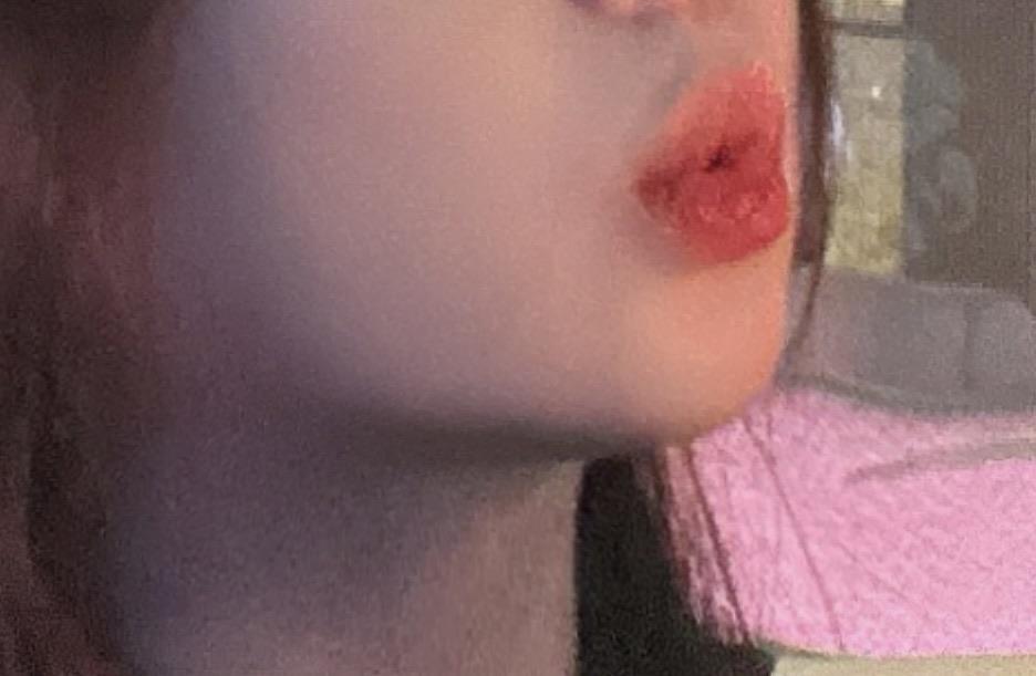 後