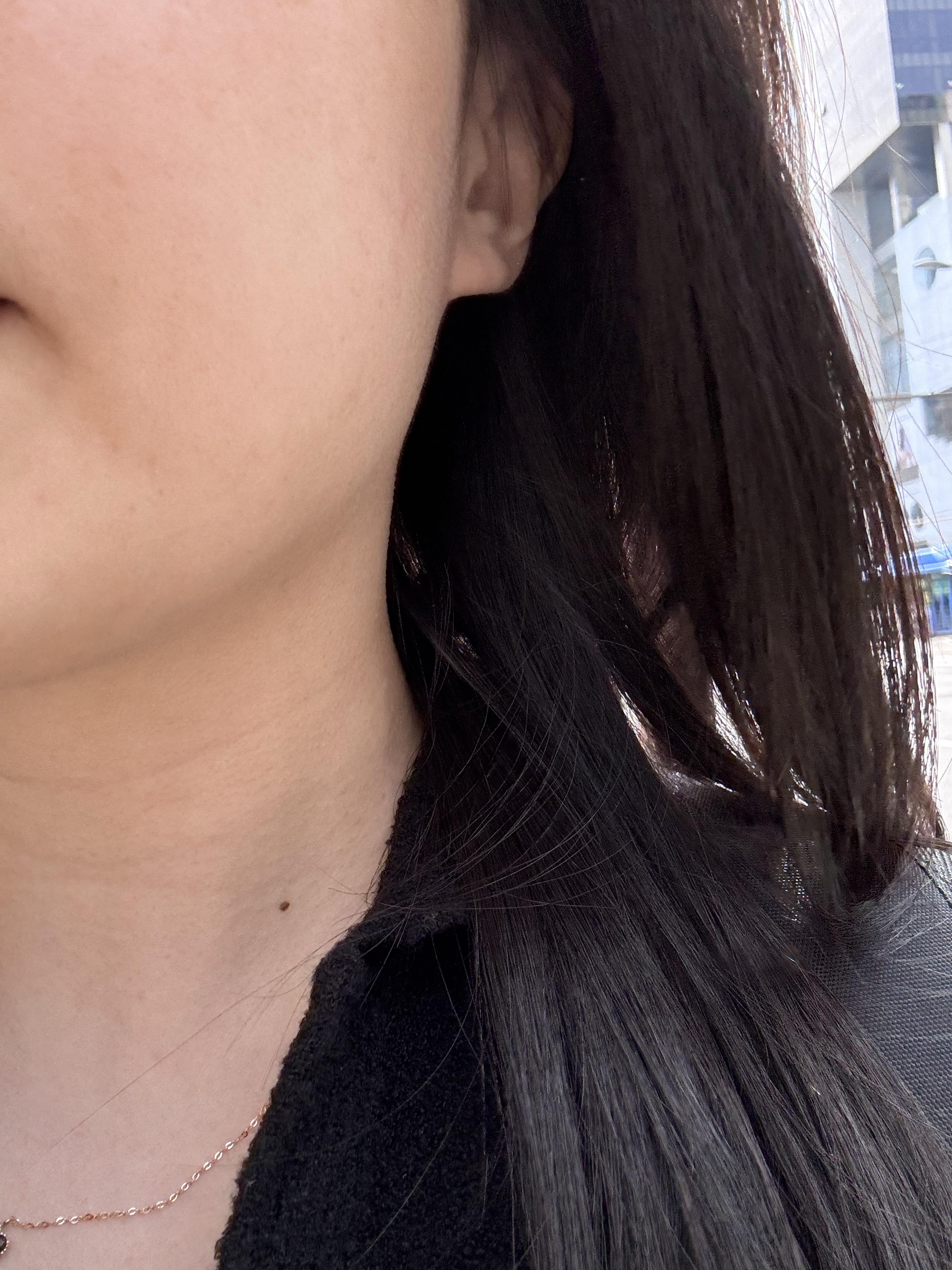 后