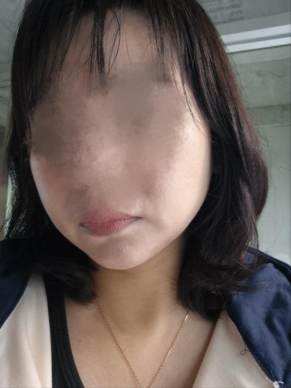 後
