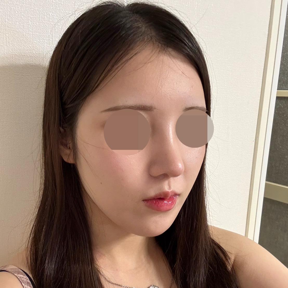 後