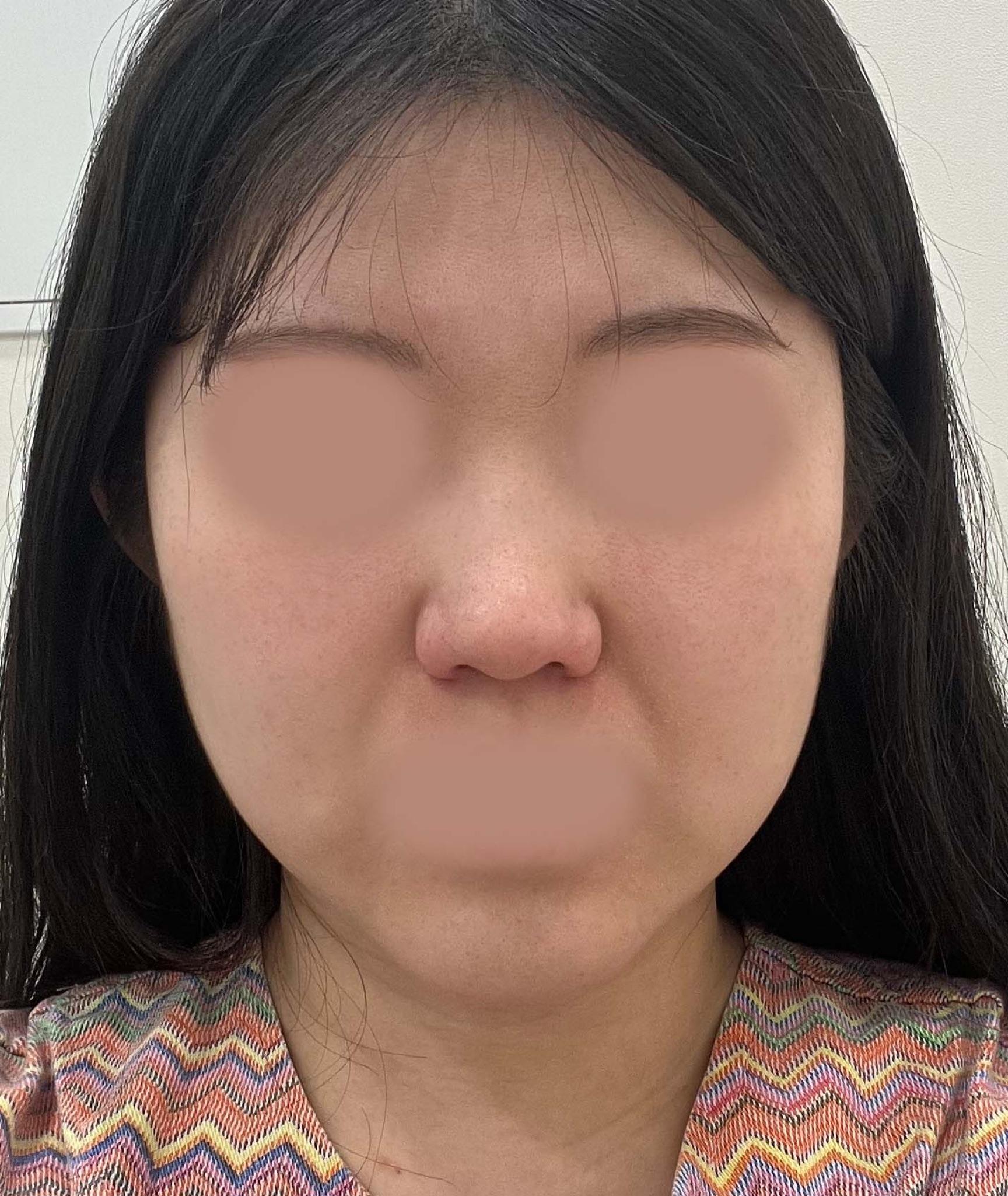 後