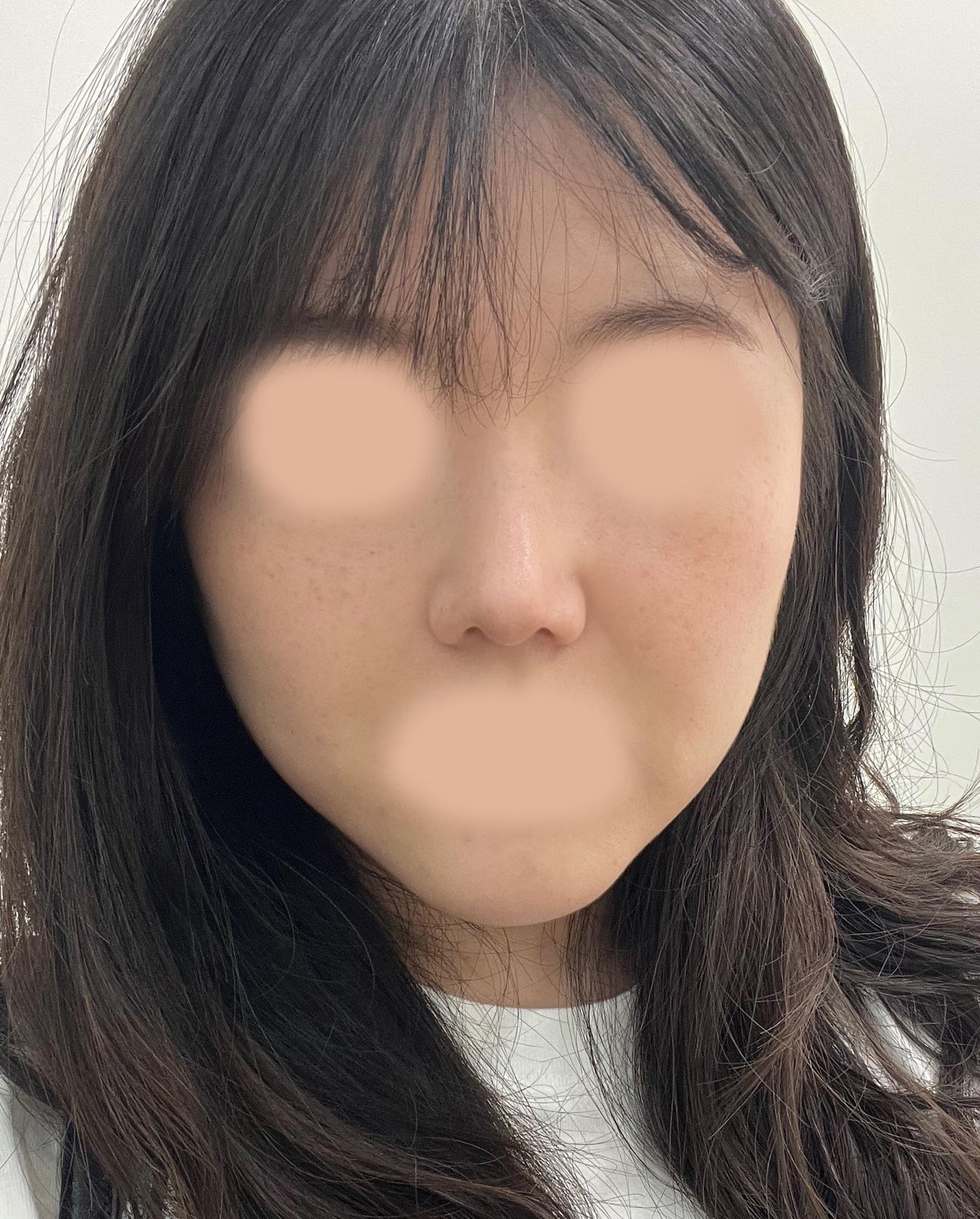 後