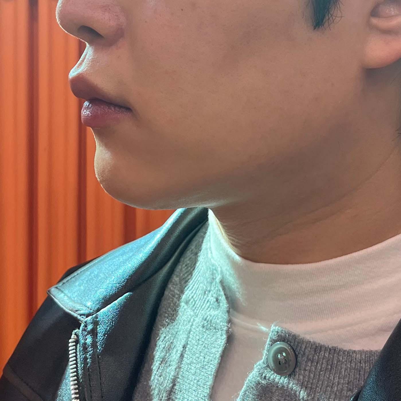 後