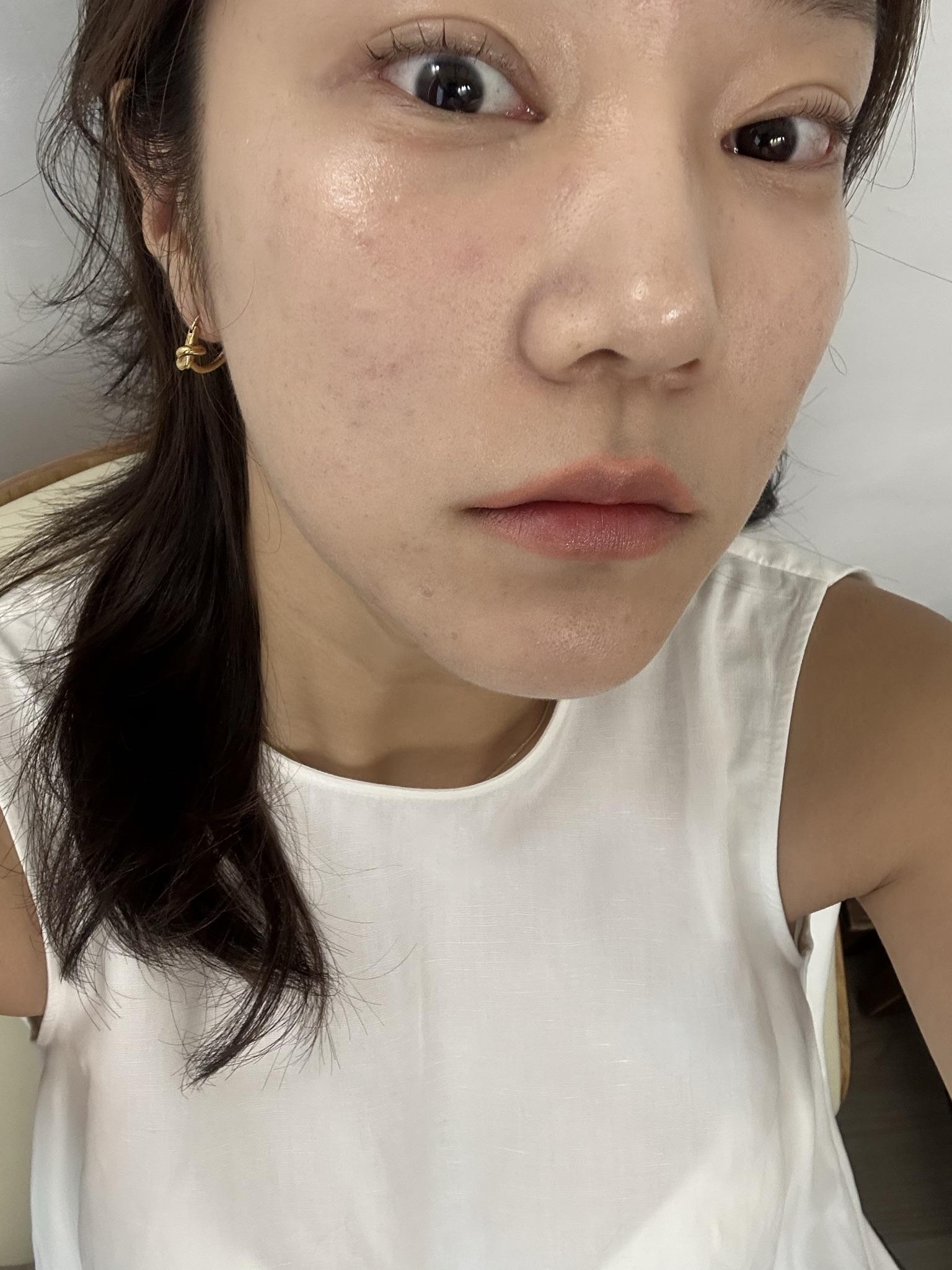 後