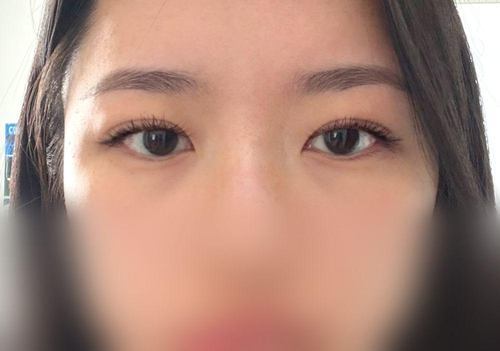 後